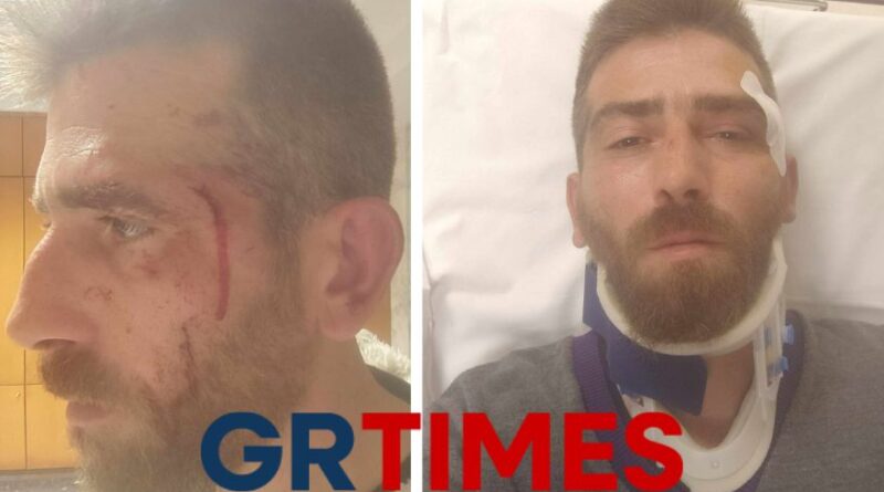 Άγρια επίθεση στη Νέα Παραλία – Θύμα άνδρας που ψάρευε σουπιές και καλαμάρια (pics)